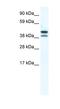TATA-Box Binding Protein Like 2 antibody, NBP1-80268, Novus Biologicals, Western Blot image 