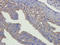 Core-Binding Factor Subunit Beta antibody, orb318782, Biorbyt, Immunohistochemistry paraffin image 