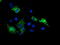 Sirtuin 5 antibody, TA503315, Origene, Immunofluorescence image 