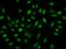 THAP domain-containing protein 11 antibody, 200268-T02, Sino Biological, Immunohistochemistry paraffin image 