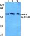 Docking Protein 1 antibody, PA5-36845, Invitrogen Antibodies, Western Blot image 