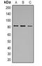 Calpain 1 antibody, orb340703, Biorbyt, Western Blot image 