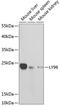 Lymphocyte Antigen 96 antibody, GTX54290, GeneTex, Western Blot image 