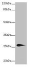 Transmembrane Protein 174 antibody, CSB-PA023755LA01HU, Cusabio, Western Blot image 