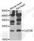 C-Type Lectin Domain Family 3 Member B antibody, A6418, ABclonal Technology, Western Blot image 