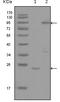 YES Proto-Oncogene 1, Src Family Tyrosine Kinase antibody, M02640, Boster Biological Technology, Western Blot image 