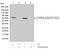 Ribosomal Protein S6 Kinase B1 antibody, 701083, Invitrogen Antibodies, Western Blot image 