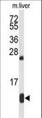Hemoglobin Subunit Alpha 2 antibody, LS-B10549, Lifespan Biosciences, Western Blot image 