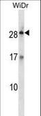 Kallikrein Related Peptidase 12 antibody, LS-C165581, Lifespan Biosciences, Western Blot image 