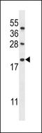 Interferon Alpha Inducible Protein 6 antibody, LS-C165121, Lifespan Biosciences, Western Blot image 