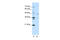 Zinc Finger Protein 488 antibody, 29-162, ProSci, Enzyme Linked Immunosorbent Assay image 