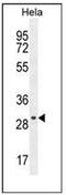 EMG1 N1-Specific Pseudouridine Methyltransferase antibody, AP51427PU-N, Origene, Western Blot image 