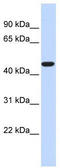 Acyl-CoA Thioesterase 2 antibody, TA346440, Origene, Western Blot image 
