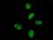 Makorin Ring Finger Protein 3 antibody, H00007681-M01, Novus Biologicals, Immunofluorescence image 