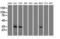 Cyclin Dependent Kinase 5 antibody, LS-C784226, Lifespan Biosciences, Western Blot image 