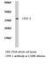 Lymphatic Vessel Endothelial Hyaluronan Receptor 1 antibody, LS-C175835, Lifespan Biosciences, Western Blot image 