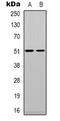 Tryptophan Hydroxylase 1 antibody, orb338838, Biorbyt, Western Blot image 