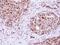 RAD23 Homolog B, Nucleotide Excision Repair Protein antibody, PA5-29840, Invitrogen Antibodies, Immunohistochemistry frozen image 