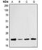 Cofilin 1 antibody, LS-C352404, Lifespan Biosciences, Western Blot image 