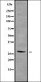Netrin 1 antibody, orb337375, Biorbyt, Western Blot image 