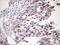 Inhibitor Of Nuclear Factor Kappa B Kinase Subunit Epsilon antibody, M01816-1, Boster Biological Technology, Immunohistochemistry paraffin image 