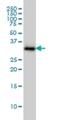 Survival Of Motor Neuron 2, Centromeric antibody, H00006607-M01, Novus Biologicals, Western Blot image 