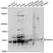 Nuclear Factor Kappa B Subunit 1 antibody, LS-C749734, Lifespan Biosciences, Western Blot image 