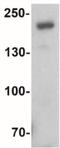 SWI/SNF Related, Matrix Associated, Actin Dependent Regulator Of Chromatin, Subfamily A, Member 4 antibody, NBP2-41270, Novus Biologicals, Western Blot image 
