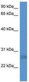 SplA/Ryanodine Receptor Domain And SOCS Box Containing 2 antibody, TA343000, Origene, Western Blot image 