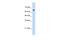 Zinc Finger Protein 326 antibody, A11692, Boster Biological Technology, Western Blot image 