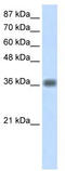 Kelch Domain Containing 8A antibody, TA343874, Origene, Western Blot image 