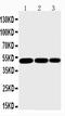 Inhibitor Of Nuclear Factor Kappa B Kinase Regulatory Subunit Gamma antibody, PA1551, Boster Biological Technology, Western Blot image 