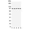 Neurotrophic Receptor Tyrosine Kinase 3 antibody, R31099, NSJ Bioreagents, Western Blot image 