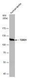 Tudor Domain Containing 1 antibody, GTX130485, GeneTex, Western Blot image 