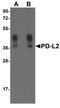 Cd273 antibody, TA355063, Origene, Western Blot image 