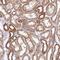 Zinc Finger Protein 211 antibody, PA5-52818, Invitrogen Antibodies, Immunohistochemistry paraffin image 