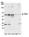 Tubulin Folding Cofactor E antibody, A305-485A, Bethyl Labs, Western Blot image 