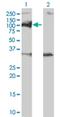 Protein Phosphatase, Mg2+/Mn2+ Dependent 1D antibody, H00008493-M01, Novus Biologicals, Western Blot image 