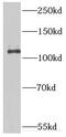 Importin 11 antibody, FNab04373, FineTest, Western Blot image 