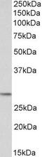 Proopiomelanocortin antibody, GTX89560, GeneTex, Western Blot image 