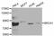 BRCA1 DNA Repair Associated antibody, MBS125516, MyBioSource, Western Blot image 