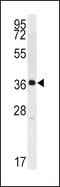Kallikrein Related Peptidase 2 antibody, PA5-13342, Invitrogen Antibodies, Western Blot image 