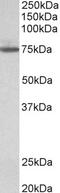 Transglutaminase 3 antibody, 42-883, ProSci, Western Blot image 