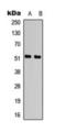 Activating Transcription Factor 2 antibody, orb393214, Biorbyt, Western Blot image 