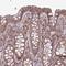 Molybdenum Cofactor Synthesis 3 antibody, NBP2-14244, Novus Biologicals, Immunohistochemistry frozen image 