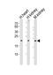 Cystin 1 antibody, A10081, Boster Biological Technology, Western Blot image 