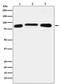 Lysine Demethylase 1B antibody, M08071, Boster Biological Technology, Western Blot image 