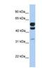 EGF Domain Specific O-Linked N-Acetylglucosamine Transferase antibody, NBP1-57931, Novus Biologicals, Western Blot image 