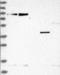 Zinc Finger And BTB Domain Containing 8A antibody, NBP1-88375, Novus Biologicals, Western Blot image 