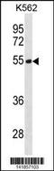 Testin antibody, 60-796, ProSci, Western Blot image 